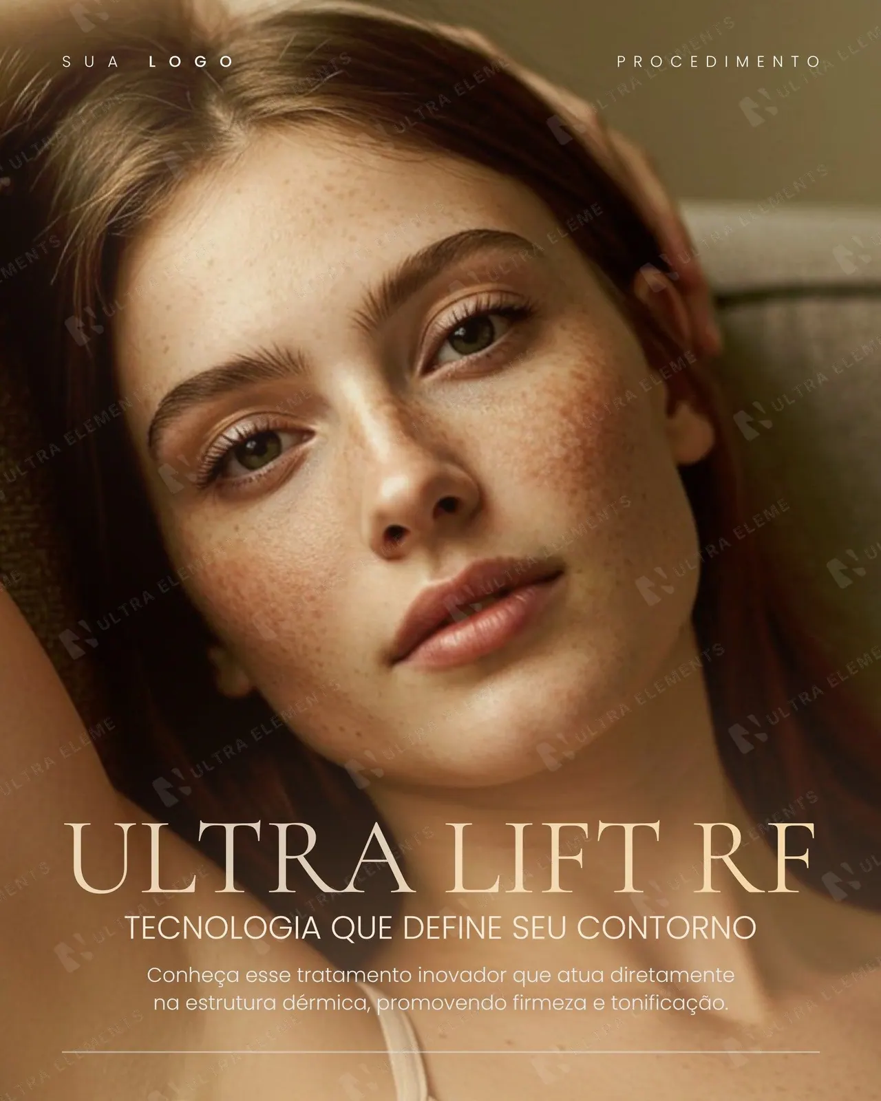 Post clínica de estética: Ultra Lift RF, retrato com sardas em luz quente (feed)