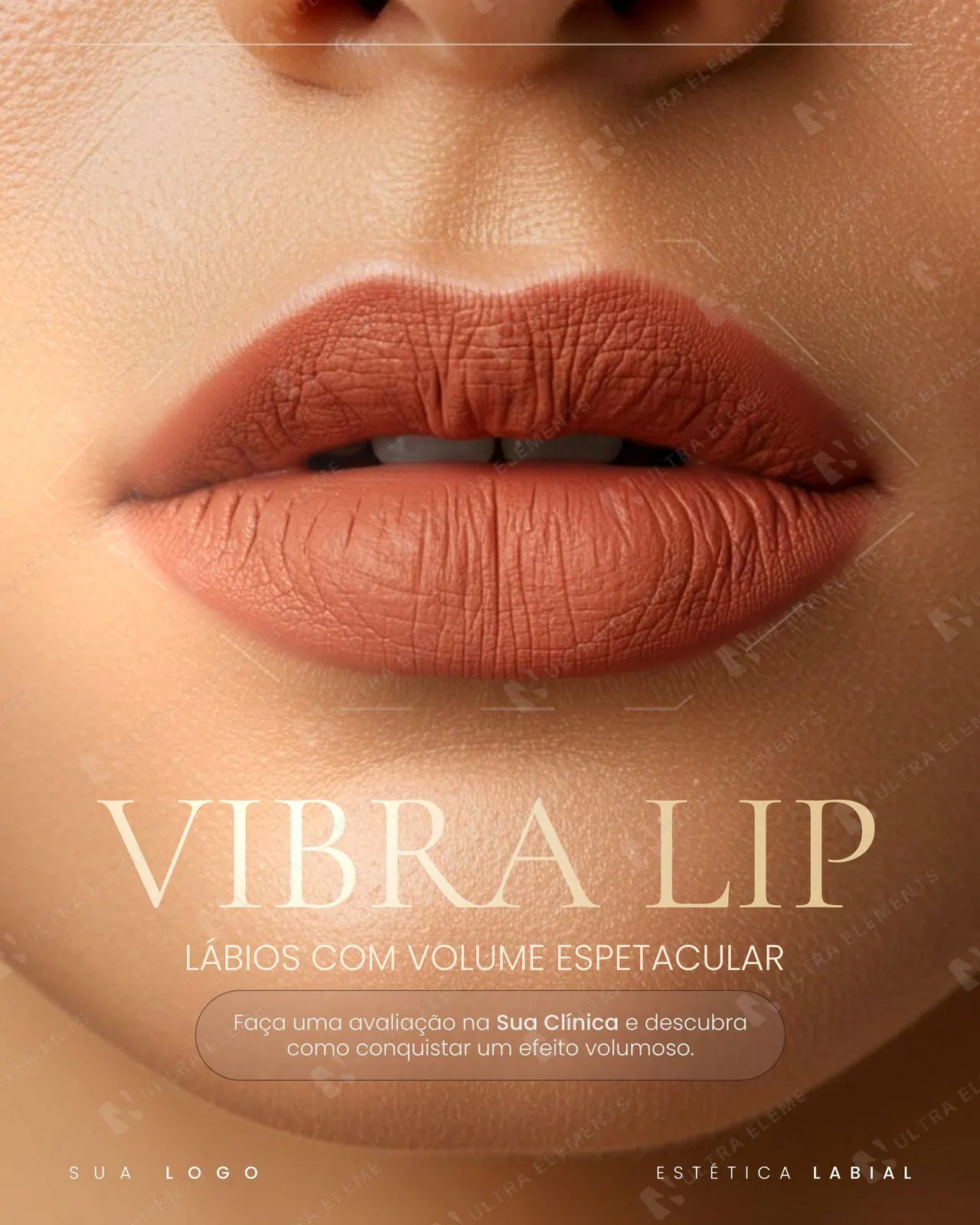 Post clínica de estética: Vibra Lip, close nos lábios para preenchimento labial (feed)