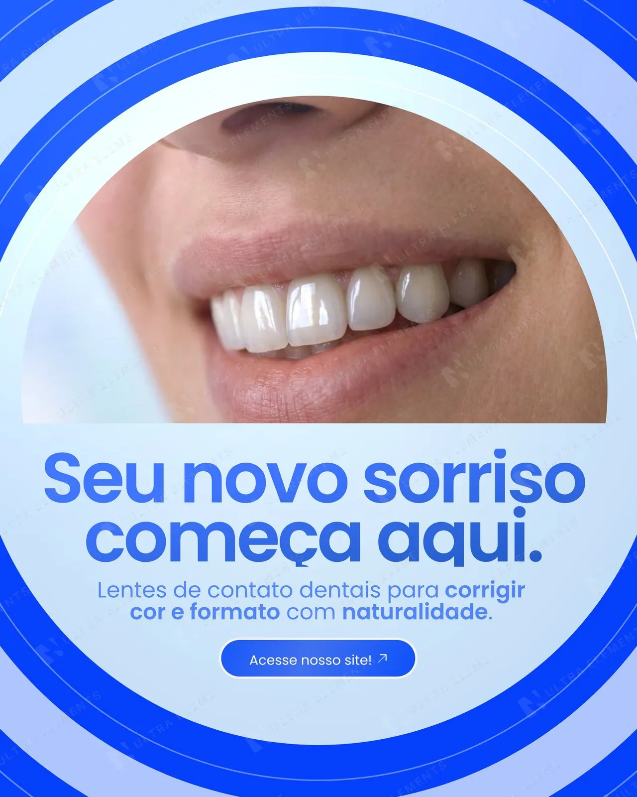 Post clínica odontológica: lentes de contato dentais com close do sorriso em círculo (feed)