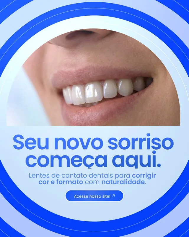 Post clínica odontológica: lentes de contato dentais com close do sorriso em círculo (feed)